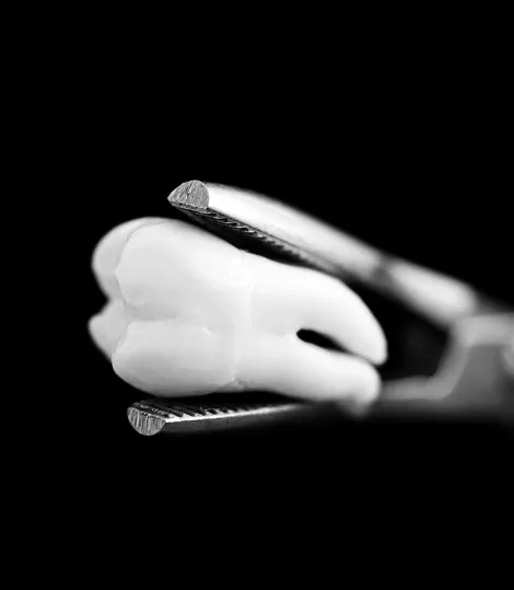 Dental membership benefits at McQuiston Dental and Aesthetics