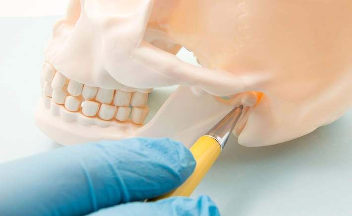 TMJ Treatment at McQuiston Dental in Alexandria, Virginia