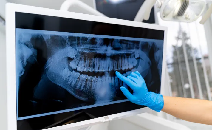 Digital X Rays at McQuiston Dental in Alexandria, Virginia