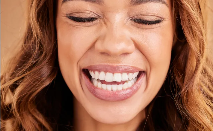 Smile Makeover at McQuiston Dental in Alexandria, Virginia