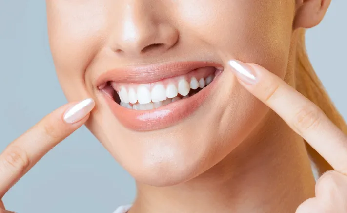 Smile Makeover at McQuiston Dental in Alexandria, Virginia